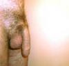 Attached Image
